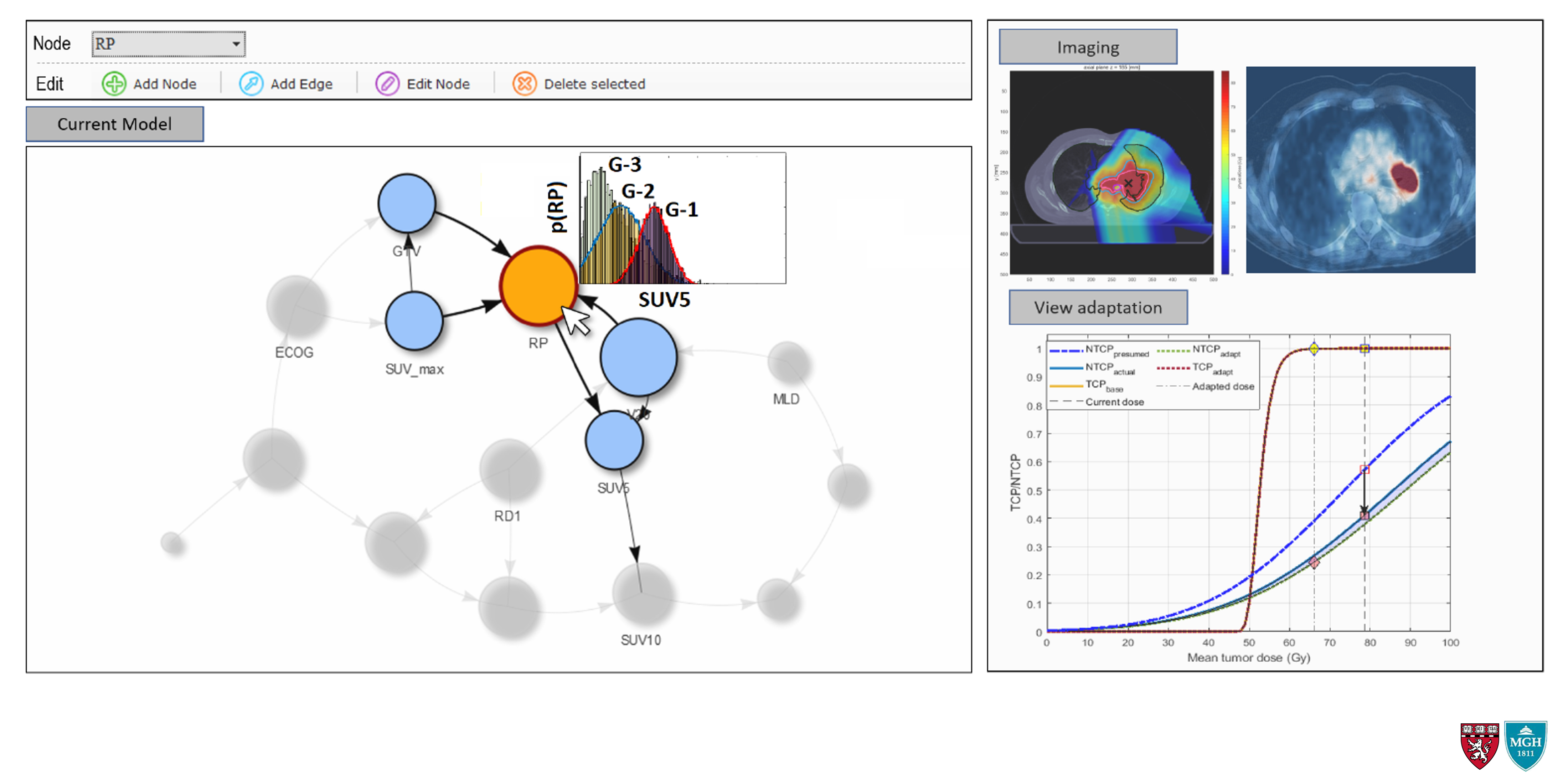 OSRT Personalized Adaptation Dashboard using interpretable machine learning (Bayesian Networks) for mid-course predicting lung radiation pneumonitis (RP)